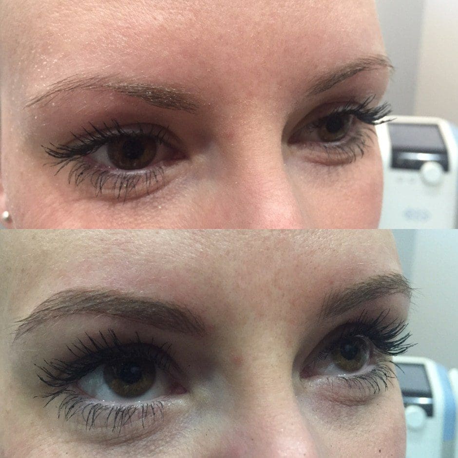 Before and after microblading showing fuller, naturally shaped brows in Louisville